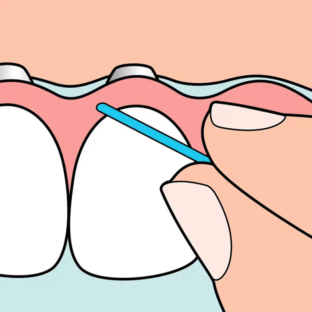 TePe Fil dentaire Bridge & Implant 30 Pièces